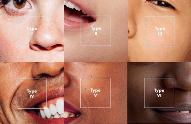 pure obagi skin types